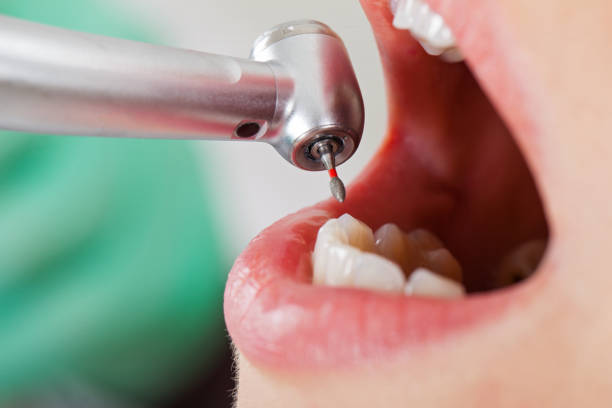 Best Emergency Treatment for Oral Infections in Lake Placid, NY